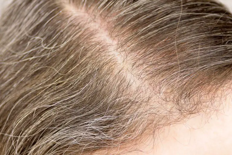 Best Ways to Get Rid of Gray Hair Best Ways to Get Rid of Gray Hair